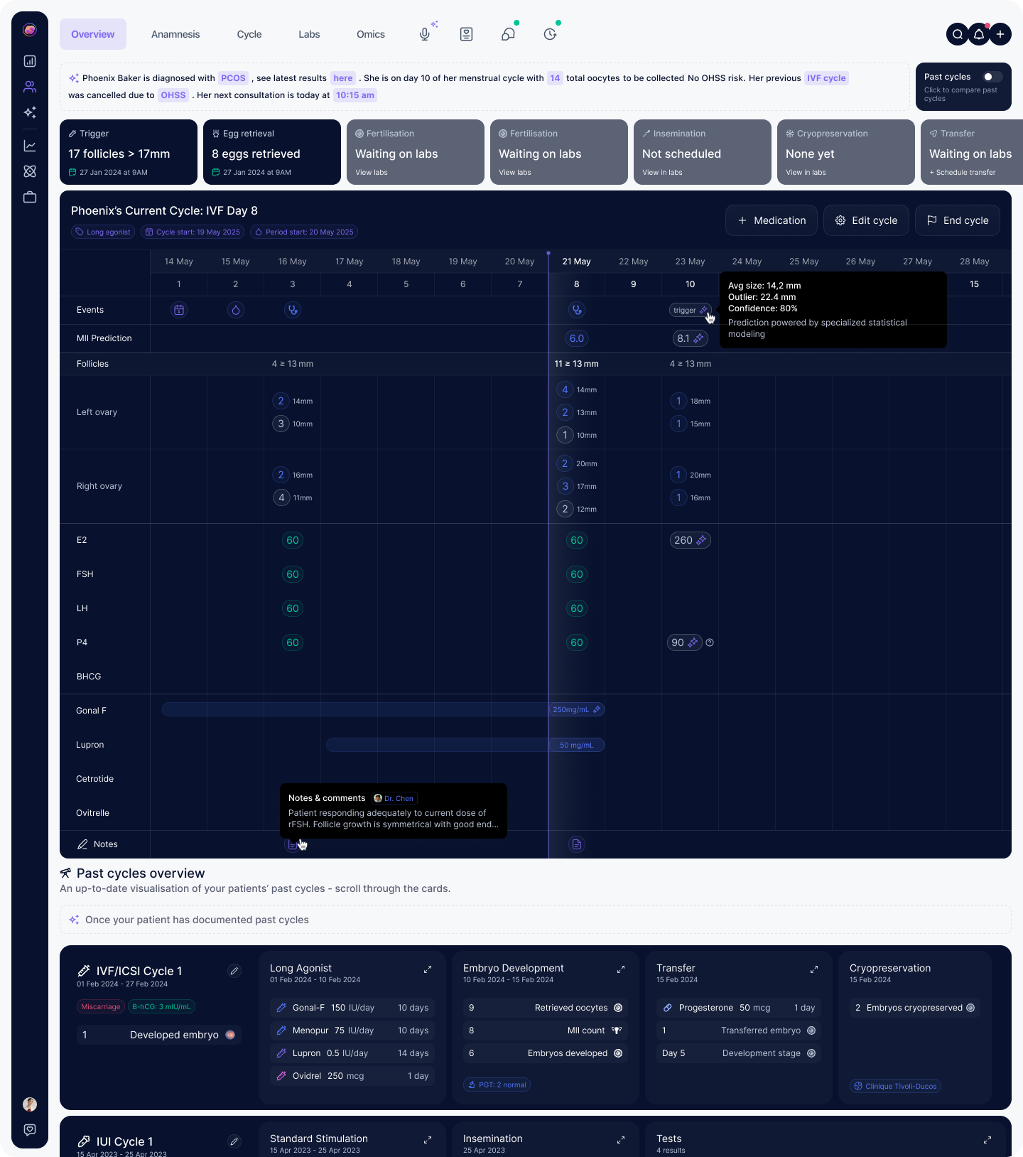 Louise IVF cycle view